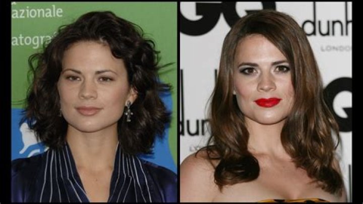 Hayley Atwell Plastic Surgery Before and After