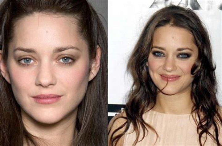 Marion Cotillard Plastic Surgery Before and After