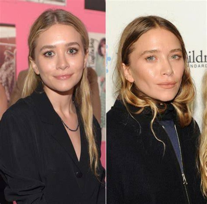 Mary-Kate Olsen Plastic Surgery Before and After
