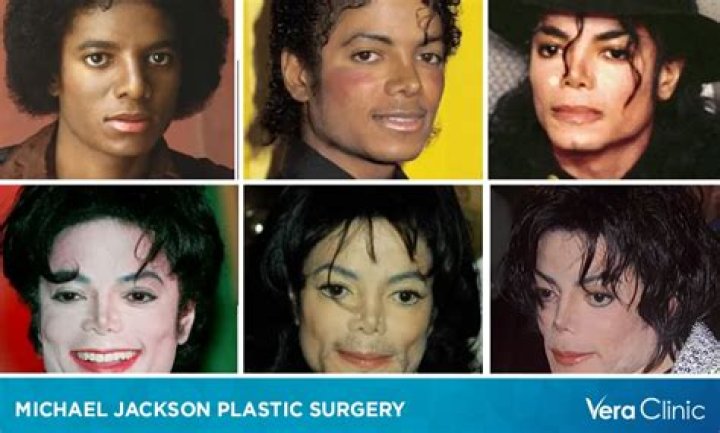 michael jackson plastic surgery