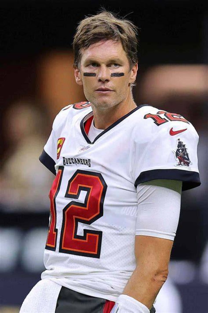 Does Brady have hair transplants? 1 Tom Brady