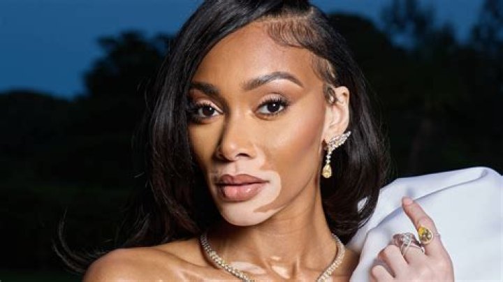 Winnie Harlow Winnie Harlow